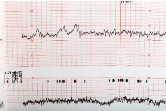 what can tmt detect