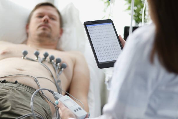 ECG Holter monitoring